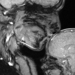 Breathtaking MRI of Mother and Baby Depicts a Bond Deeper Than Flesh